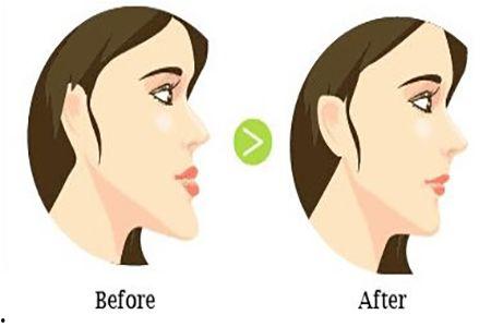 成人偏头可以矫正吗视频,揭秘矫正方法与效果